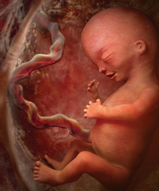 12 week fetus