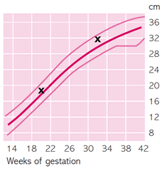 Baby Growth Chart Length