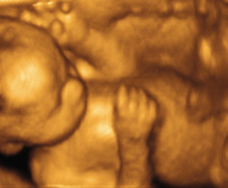 ultrasound of human fetus as 28 weeks exactly