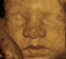 ultrasound of human fetus 29 weeks and 5 days