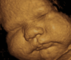 ultrasound of human fetus 40 weeks exactly